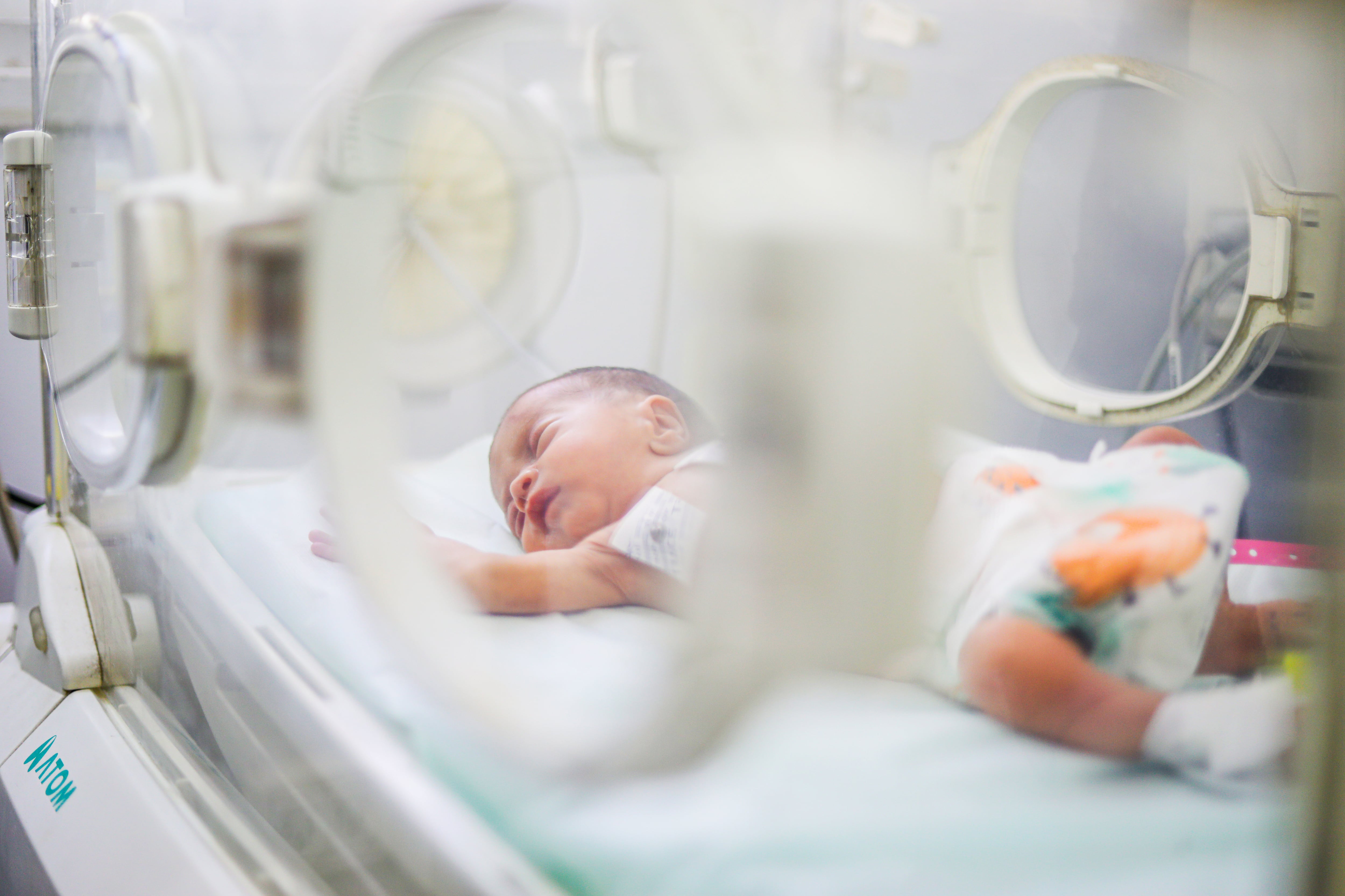 Niño prematuro en una incubadora.