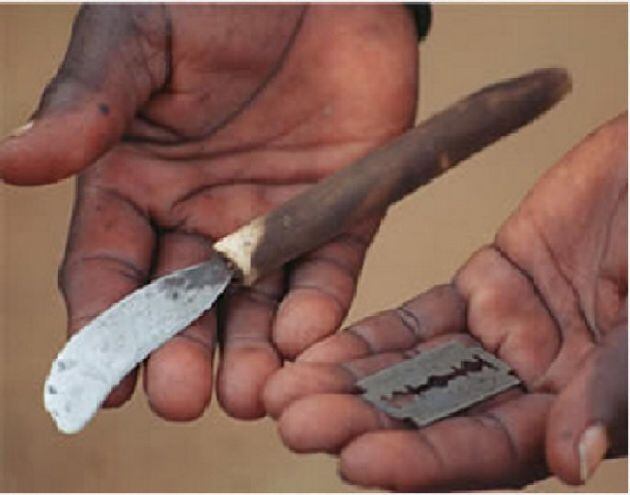 Herramientas usadas para una mutilación genital femenina (FGM)