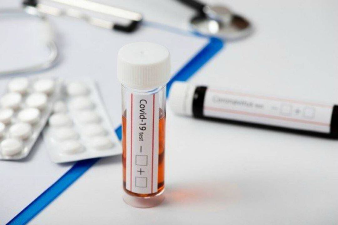 Los test de antígenos son una herramienta para controlar la pandemia