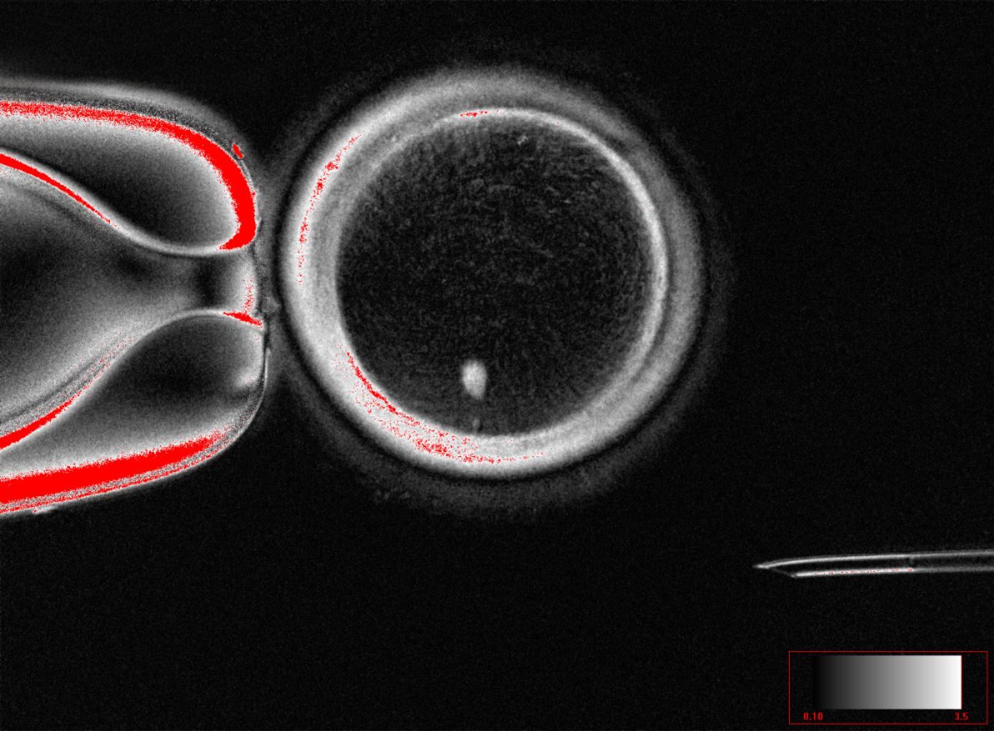 Ovocito con transferencia del núcleo de una célula de la piel antes de la fecundación