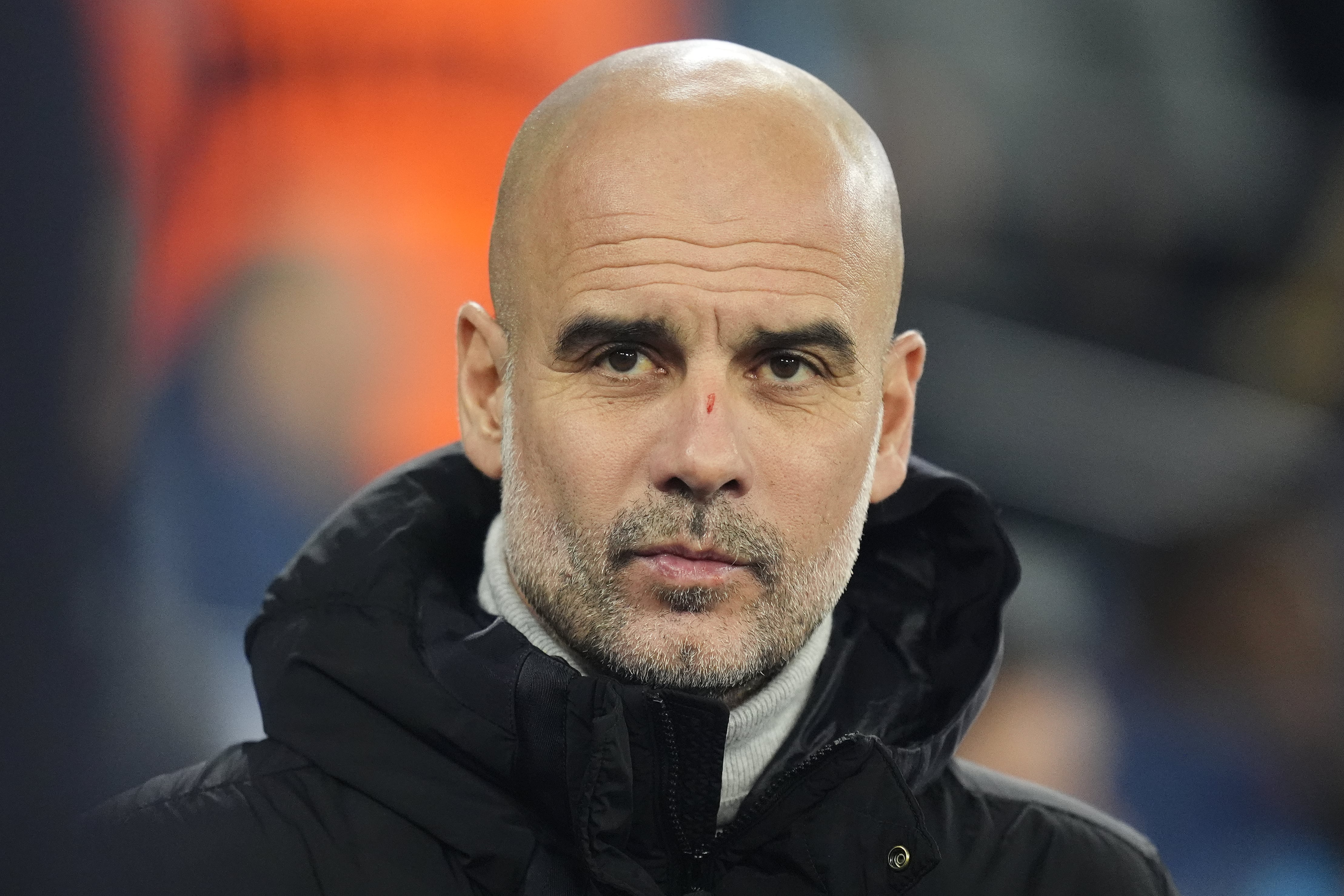 Pep Guardiola finaliza el Manchester City - Feyenoord con heridas en su rostro