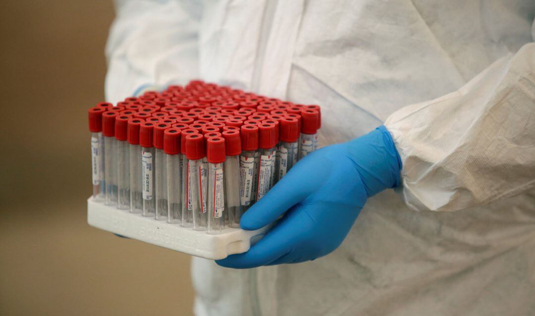 Varias muestras de test de coronavirus.