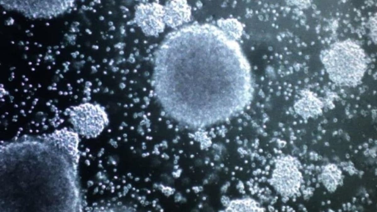 Un fármaco logra eliminar el cáncer en la mitad de los afectados tratados