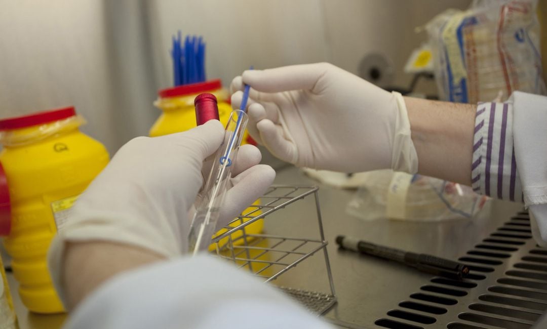 Un médico maneja una muestra de un test de Covid-19.