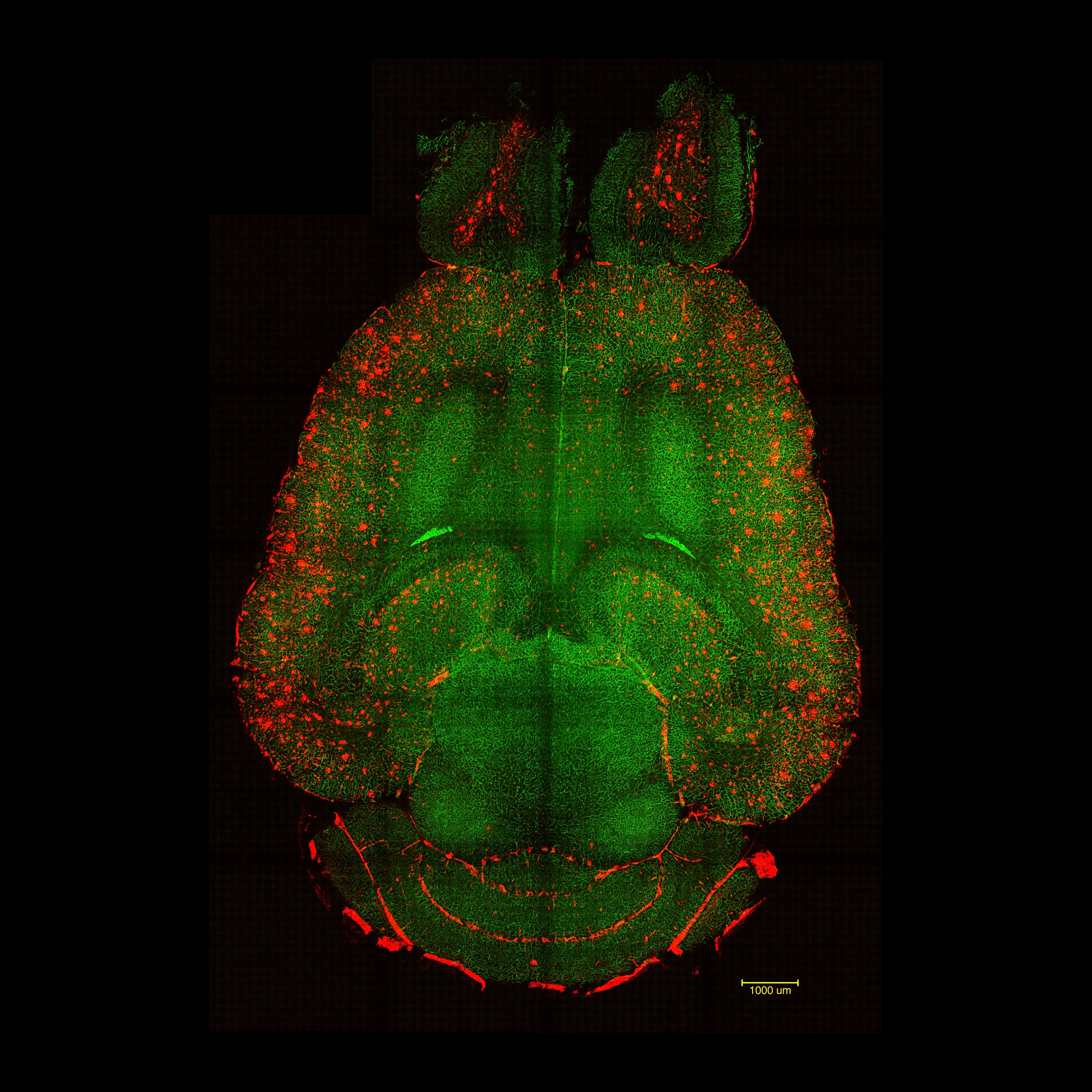 Imágenes de microscopía de fluorescencia basada en hoja de luz del cerebro de un ratón 12 horas después de NO haber sido tratado con nanopartículas. Se analizaron los cerebros para ver la cantidad de acumulación de placas Aβ. Rojo: placas Aβ. Verde: vasos sanguíneos de la barrera hematoencefálica.