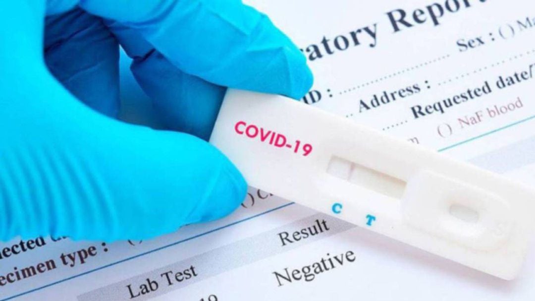 La pandemia sigue manteniendo altos niveles de contagio