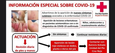 Información sobre las lesiones en los pies compatibles con el COVID19