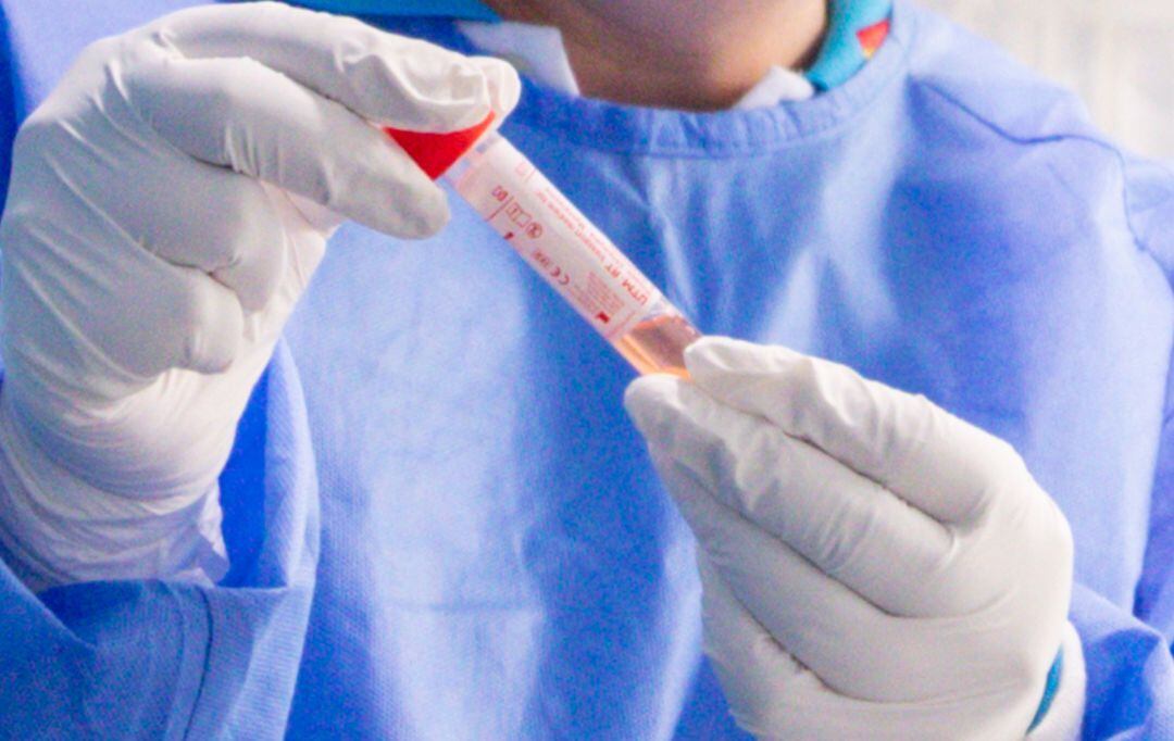 Un trabajador sanitario protegido sostiene una de las probetas utilizadas para la realización de tests PCR