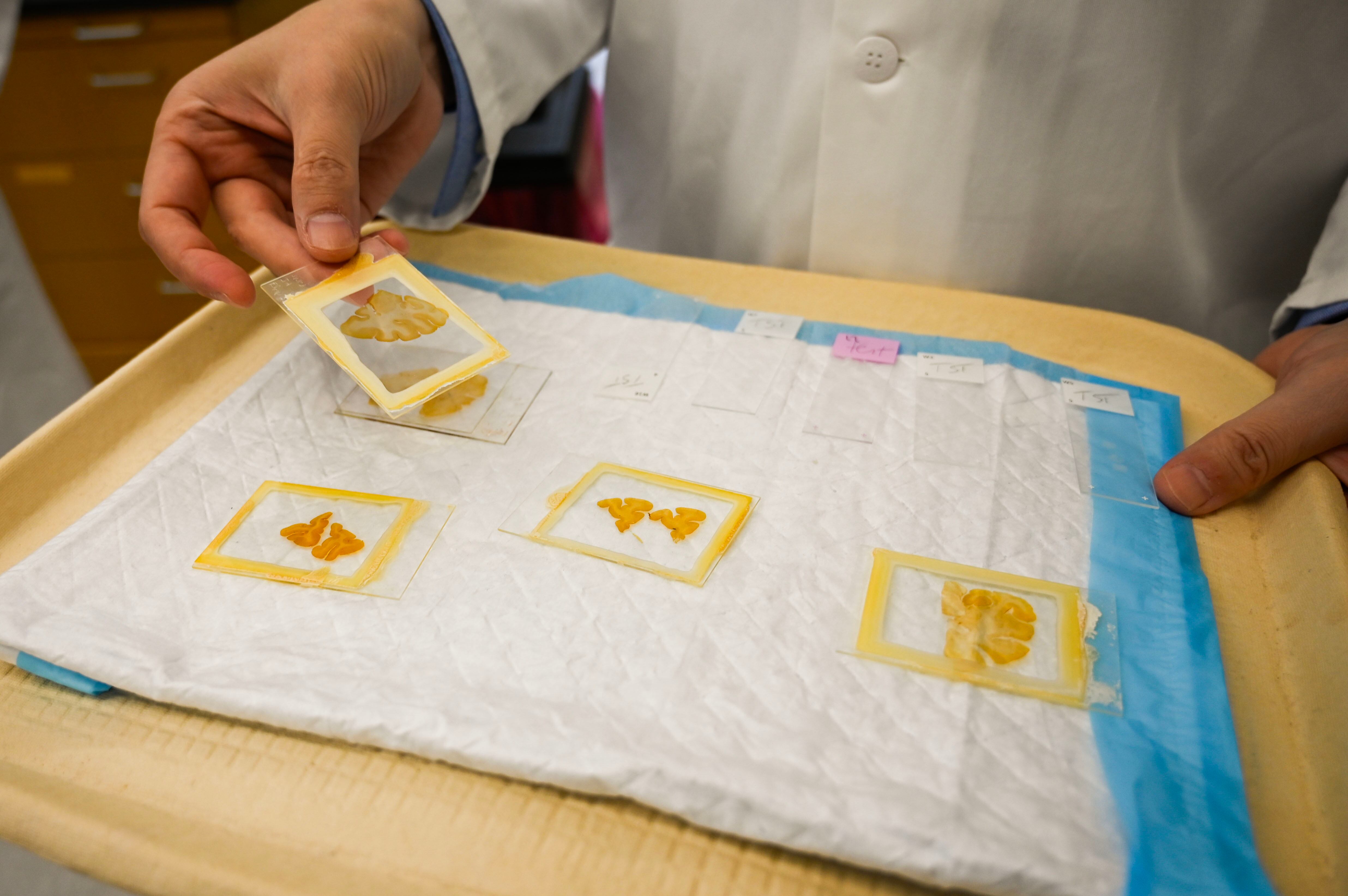 Boston, MA - August 4: Liviu Aron, an author of a recent medical paper detailing findings about lithium's connection to Alzheimer's disease, looks at samples of human and mouse brains in a Harvard research lab on August 4, 2025. (Photo by Heather Diehl/The Boston Globe via Getty Images)