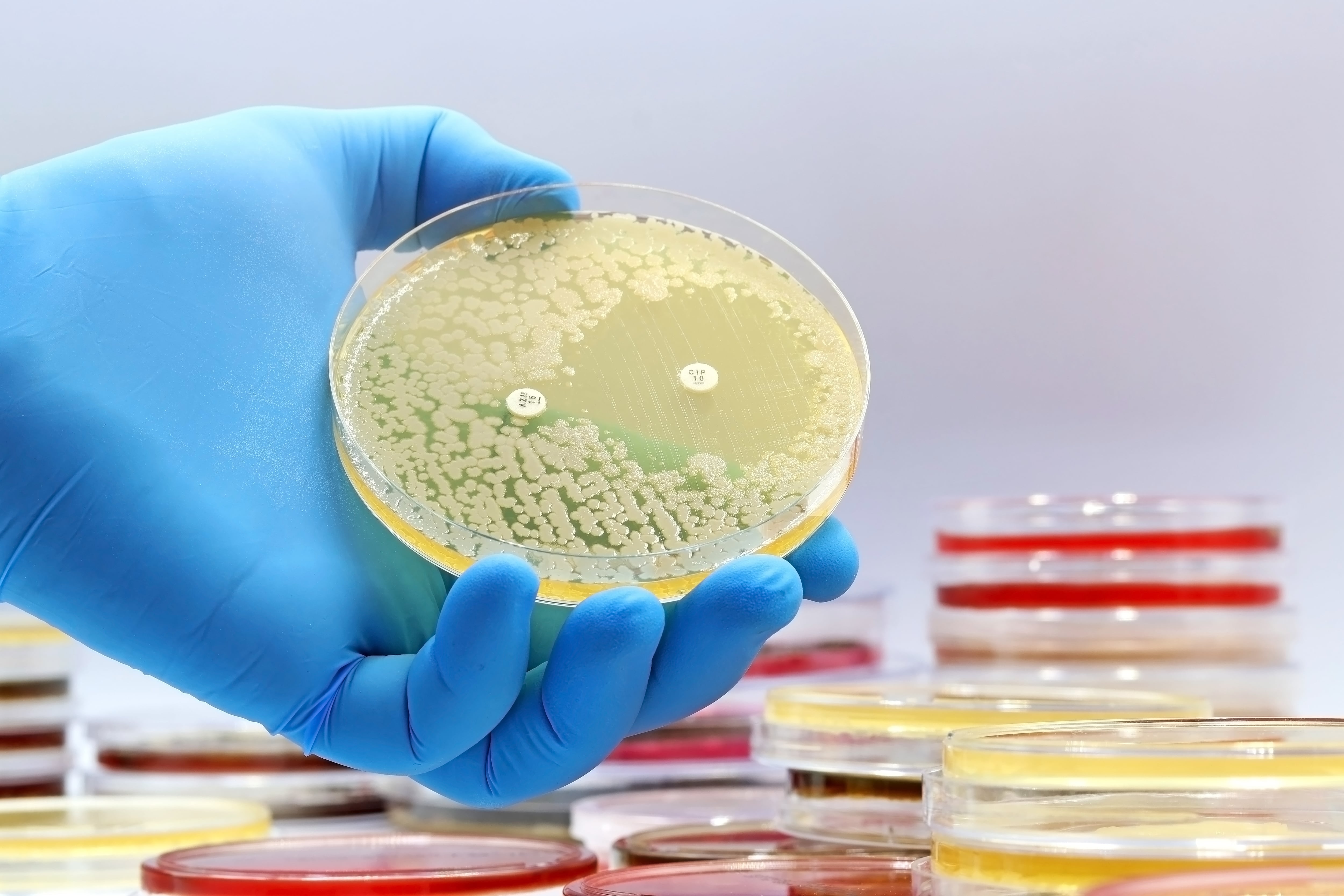 The rise of antibiotic-resistant bacterial infections. Super bugs. A microbiological culture Petri dish with bacteria and an antibiotic resistance test