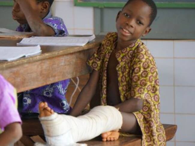 Alguno de los niños operados en África por Imanol Vega de la Ong Adato Elkartea