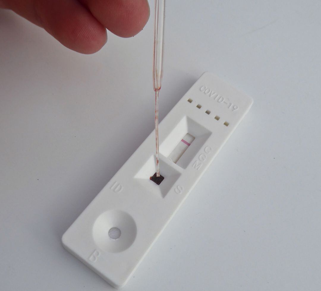 Los primeros test de anticuerpos llegarán a las farmacias de Cantabria en unos días.