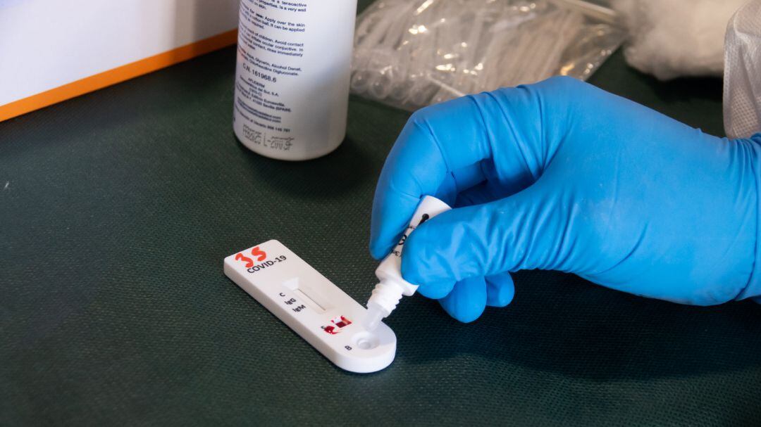 Imagen de recurso de una mesa con pruebas de anticuerpos de detección del coronavirus