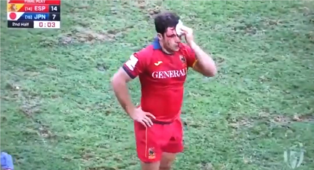 El jugador de la selección española de rugby sanando la brecha