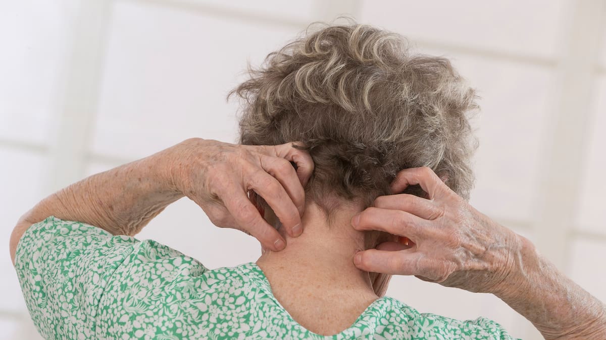 La sarna: una enfermedad muy molesta pero no peligrosa y con tratamiento