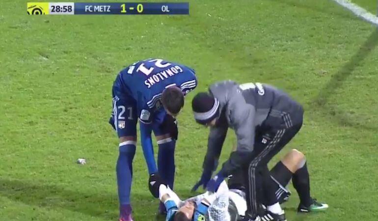 Anthony Lopes, portero del Lyon, tras el impacto del petardo