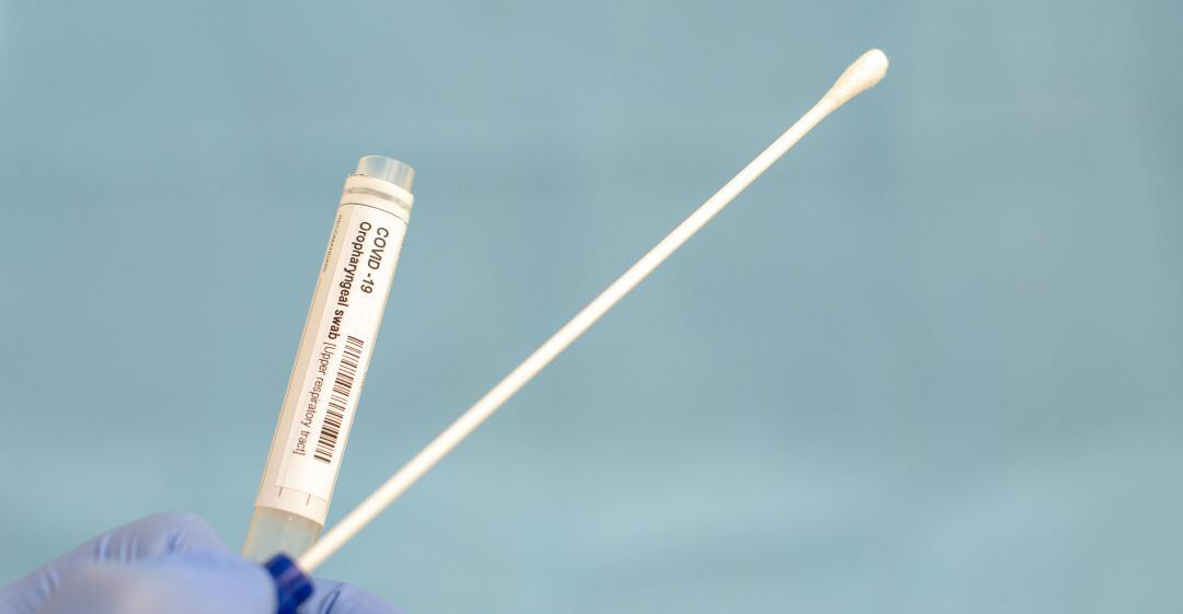 Una de las pruebas para detectar el coronavirus