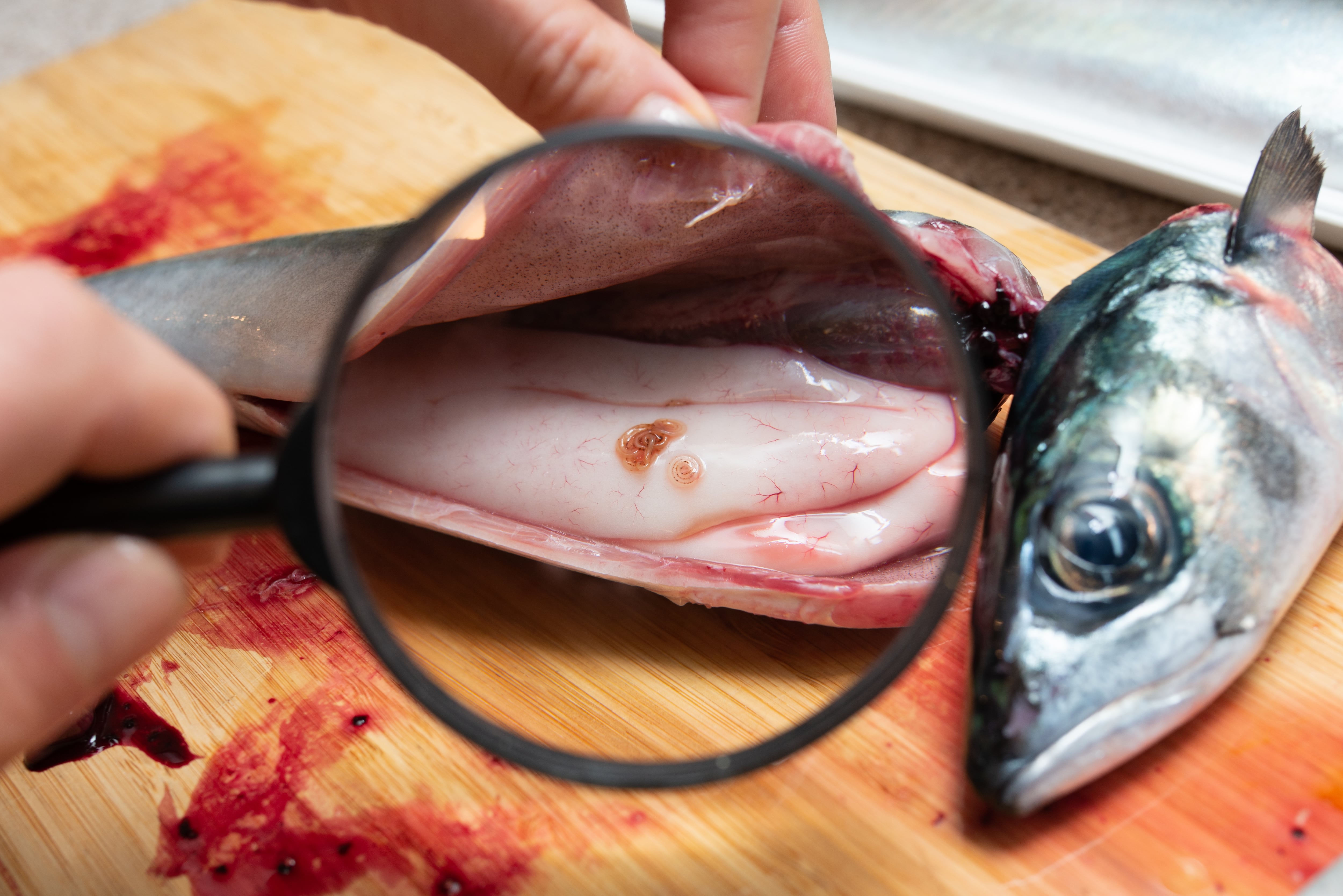 Anisakis, a vista de lupa.