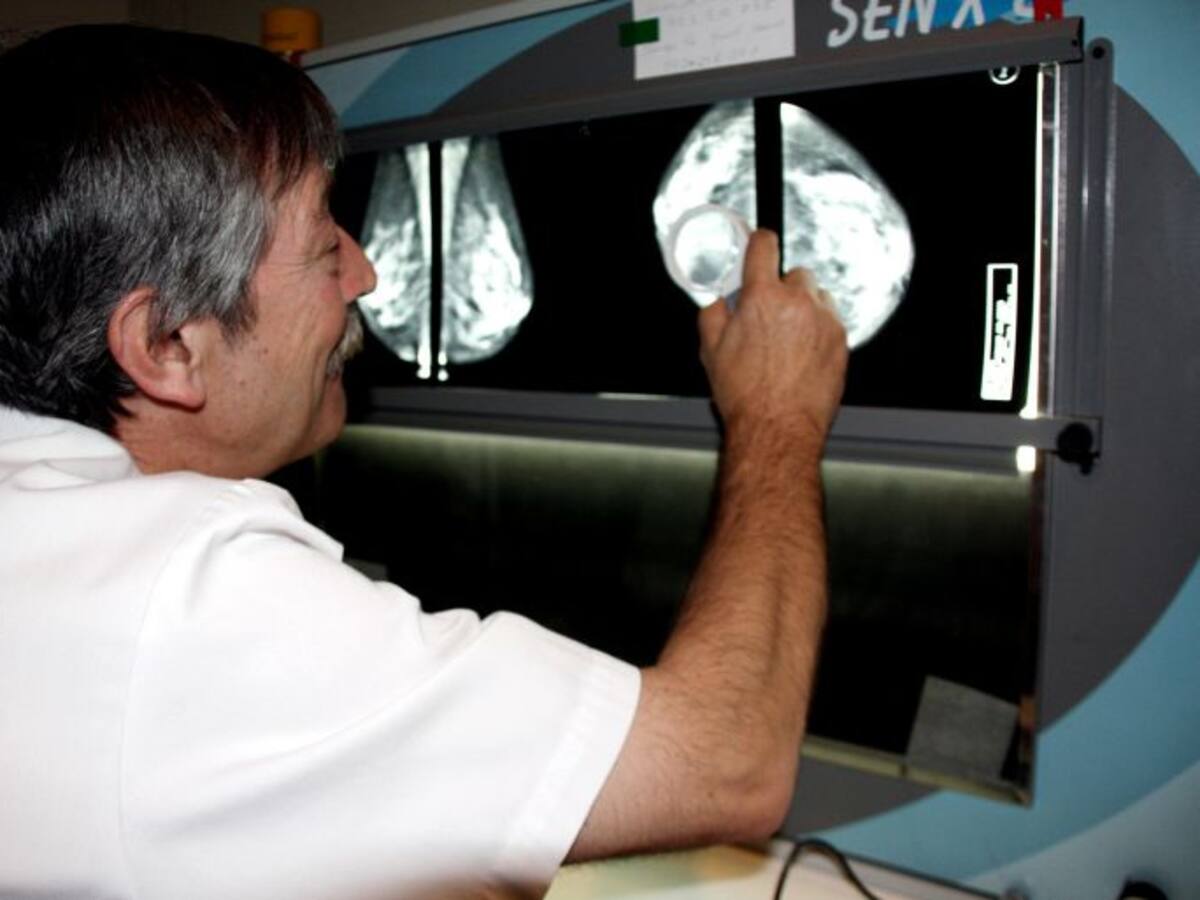 EL CÀNCER DE MAMA ES POT CURAR AMB PREVENCIÓ