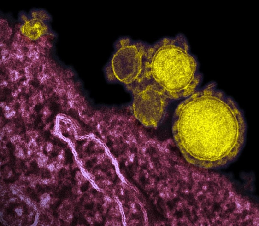 Coronavirus