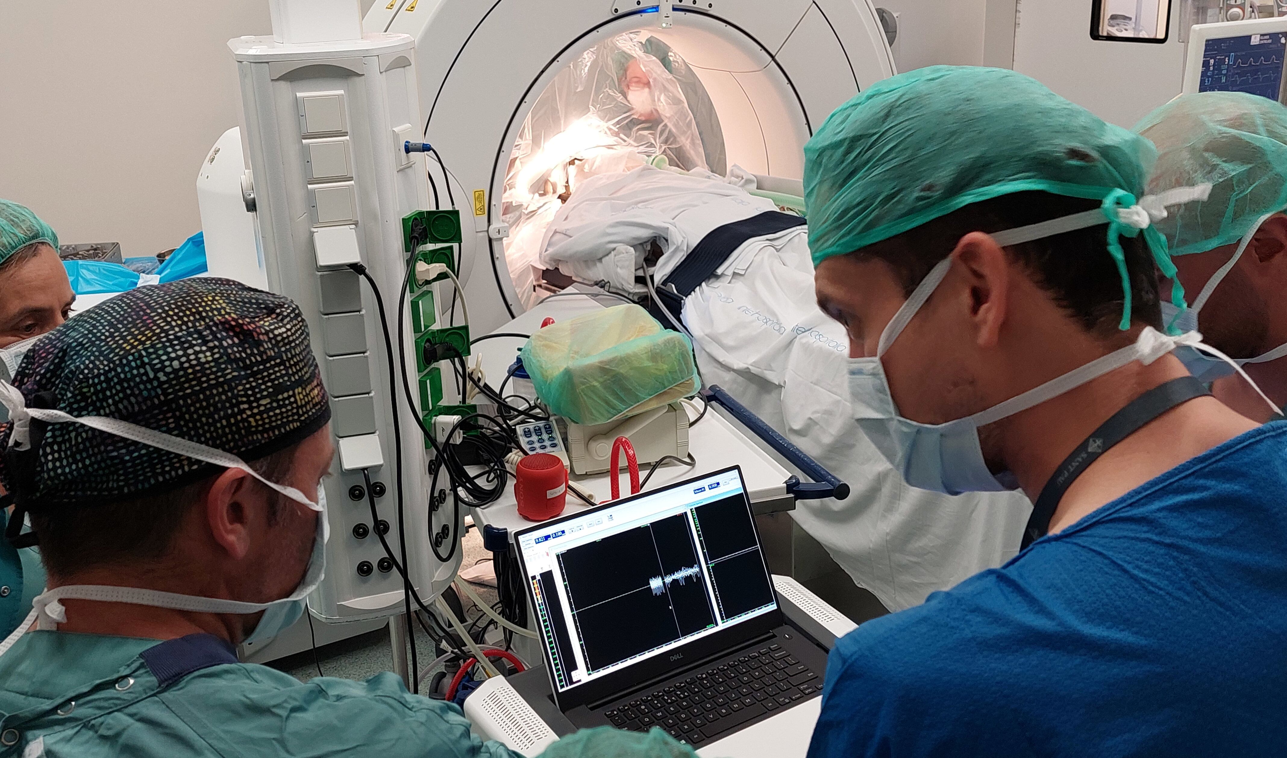 Operación de neurocirugía para implantar ECP a un paciente para mejorar el síndrome de Tourette