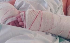La menor precisó intervención quirúrgica