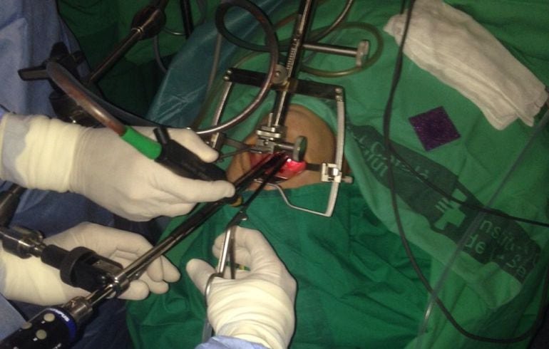 L'Hospital Josep Trueta fa una operació de laringe amb tecnologia 3D pionera a Catalunya