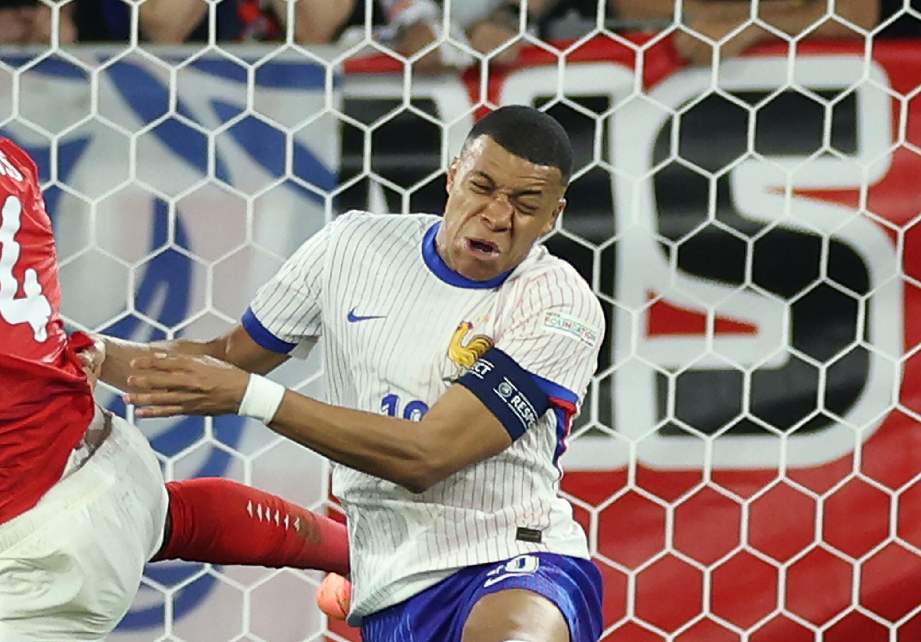 Kylian Mbappe, con el tabique nasal desplazado, tras el impacto con Danso. (Kevin C. Cox/Getty Images)