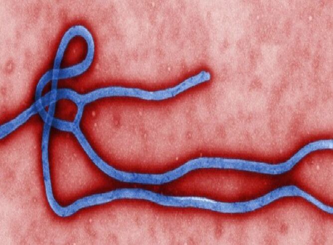 Virus del Ébola