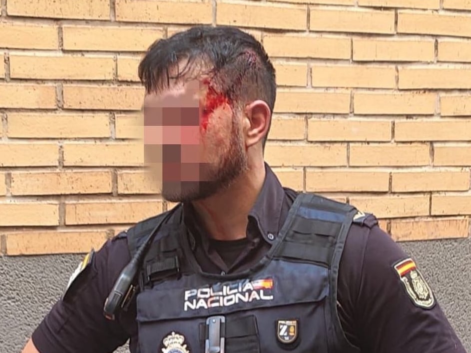 Agente de la Policía Nacional agredido en Murcia