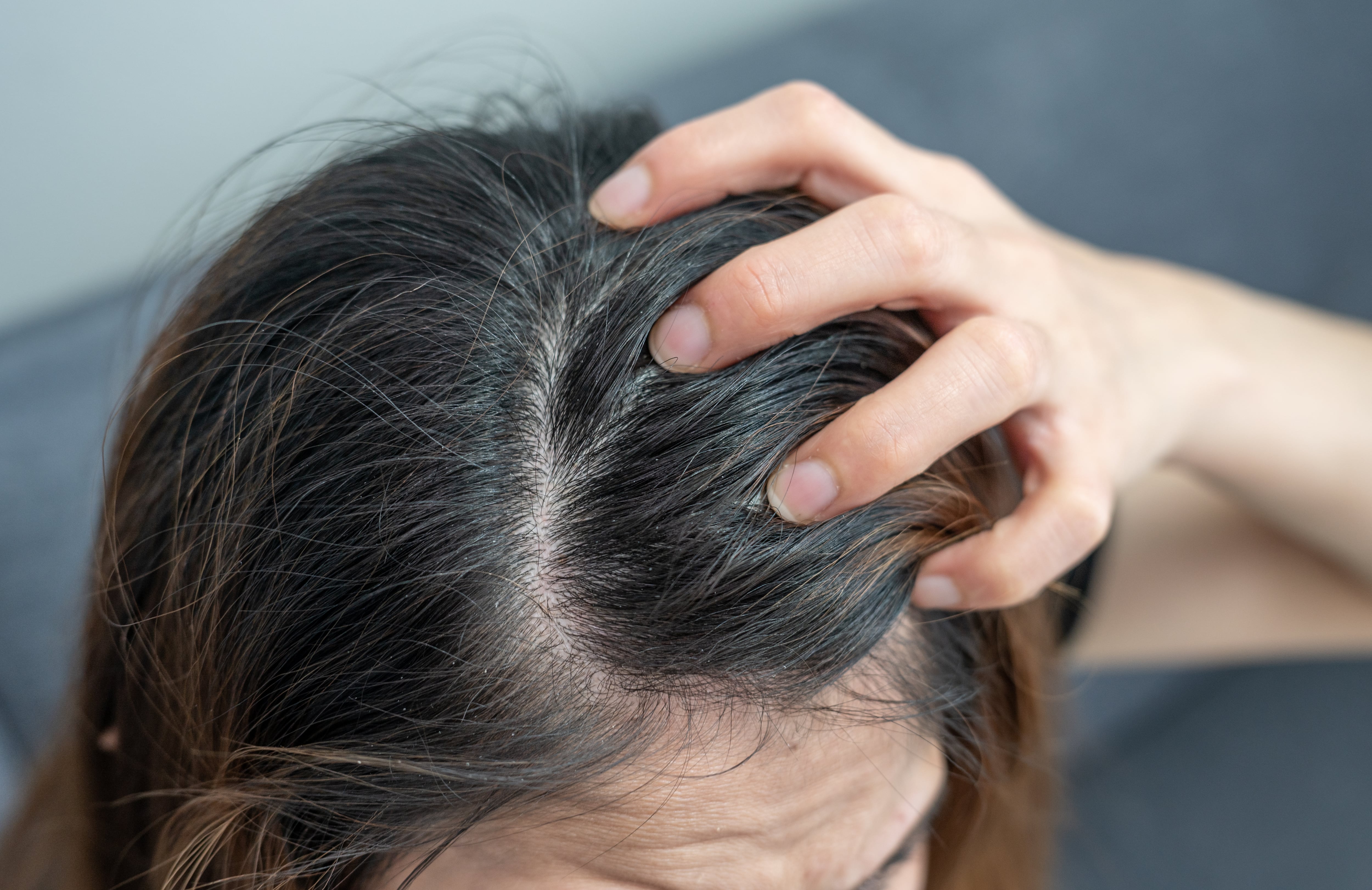 El pelo también puede ser un reflejo de lo que ocurre dentro de nuestro cuerpo