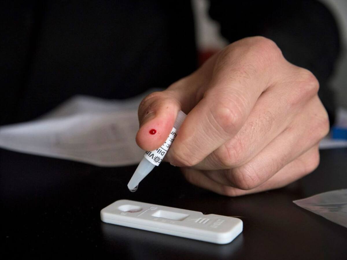 Solo el 1,7% de los gaditanos tienen anticuerpos contra el coronavirus