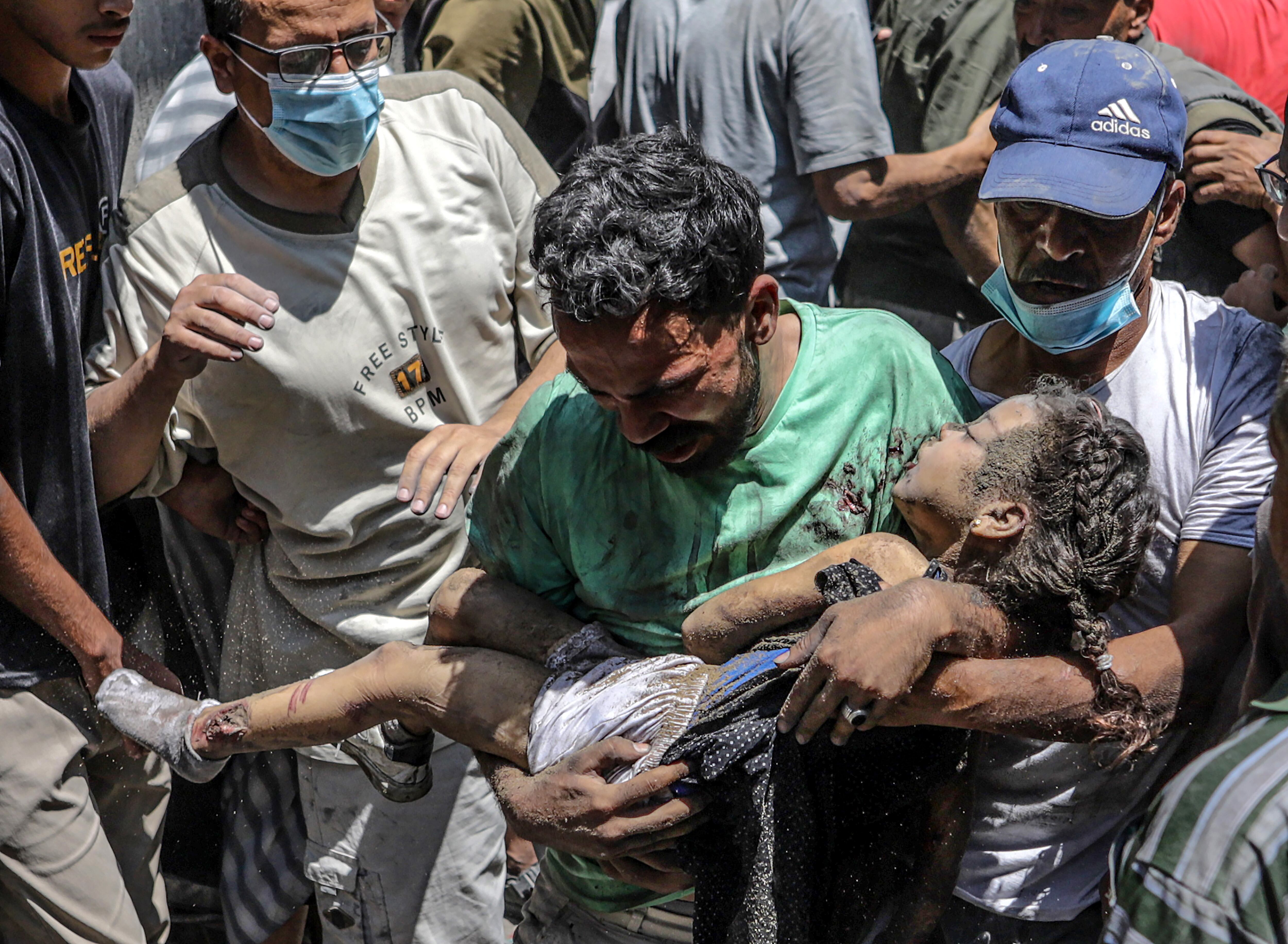 Un hombre lleva el cuerpo de un niño desnutrido, en la ciudad de Gaza. EFE/EPA/MOHAMMED SABER 