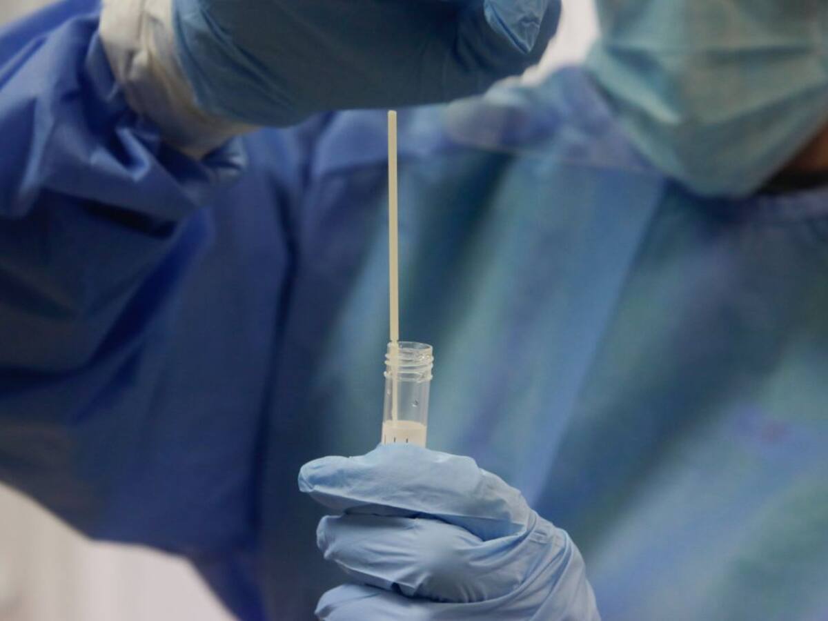 Castilla y León registra 2.081 nuevos positivos y 39 fallecidos