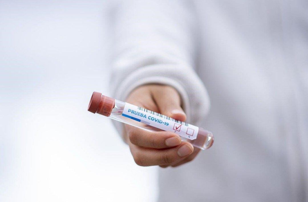 Prueba PCR para detectar la COVID-19.