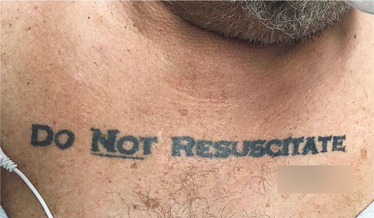 El tatuaje del paciente.