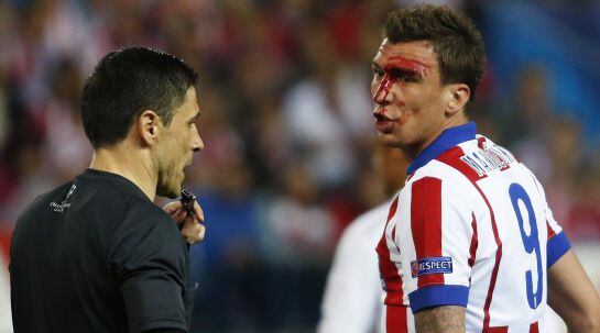 Mario Mandzukic, con el rostro ensangrentado por un codazo de Sergio Ramos.