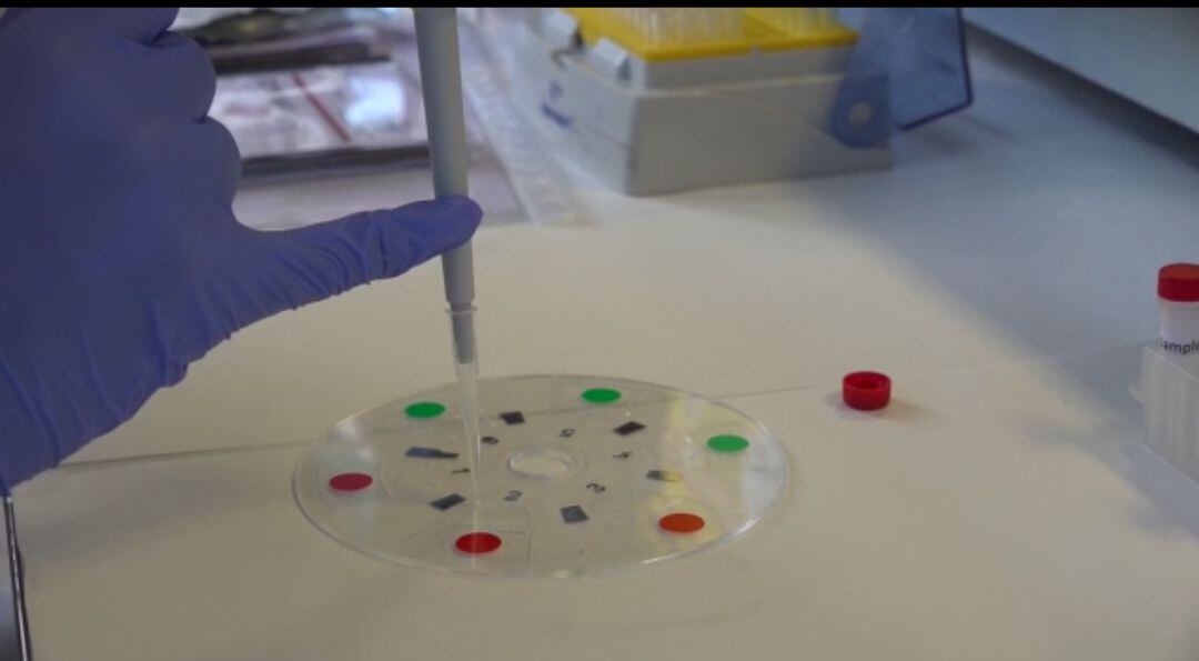 Test Covid rápido de la UPV