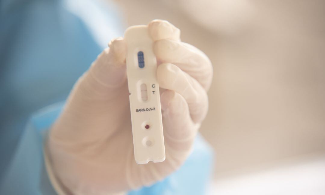 Ya se pueden consultar los datos de coronavirus en la provincia