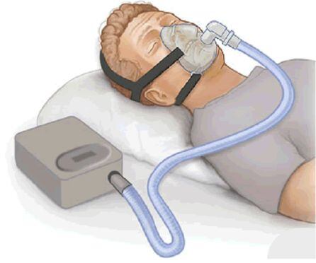 CPAP o máquina de presión positiva