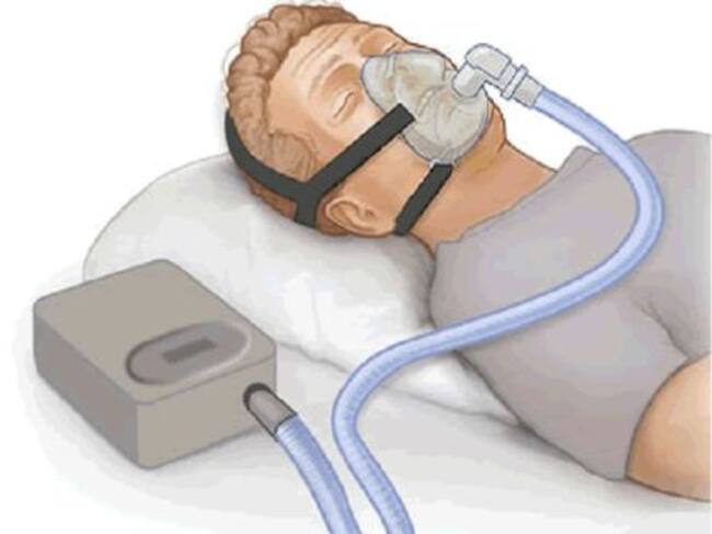 CPAP o máquina de presión positiva