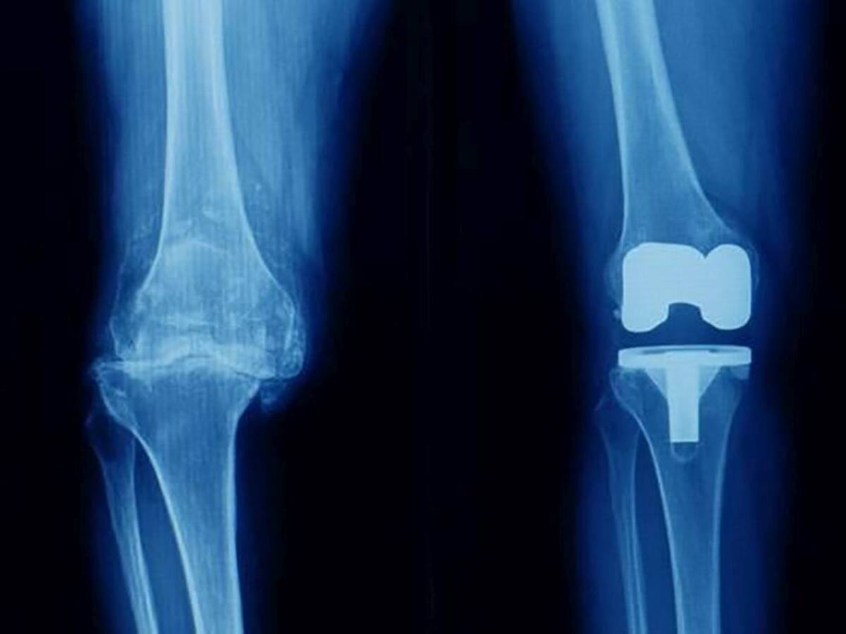 La Junta adjudica procedimientos quirúrgicos de traumatología