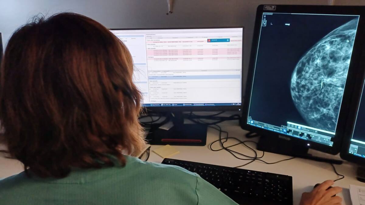 Bernabé Castro, presidente Sindicato Médico Jaén: "Una vez que te quitan tres radiólogos para hacer mamografías para dejar otras actividades, hay un incremento de las listas de espera"