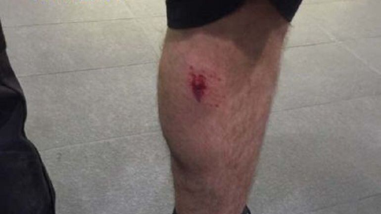 Una mujer muerde al policía que quiso identificarla