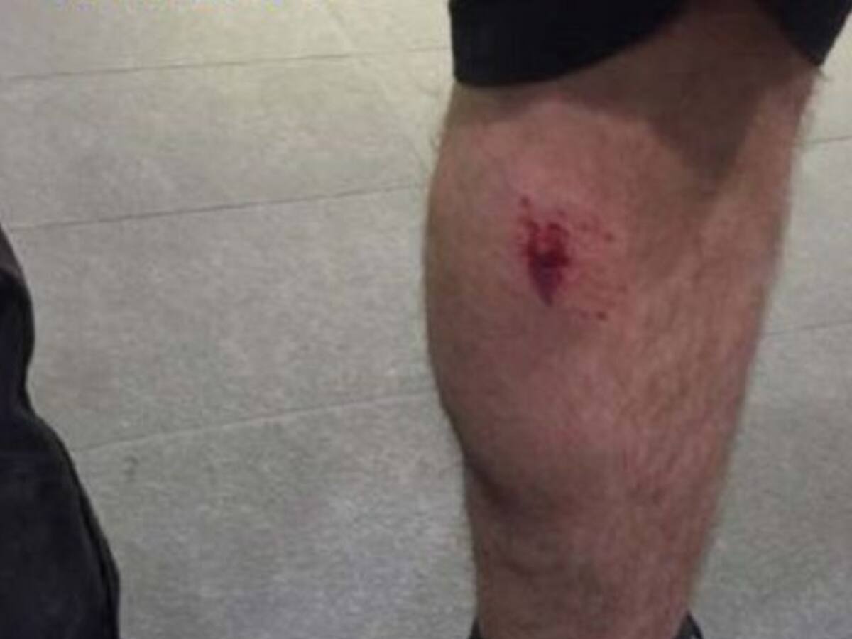 Muerde al policía que quiso identificarla