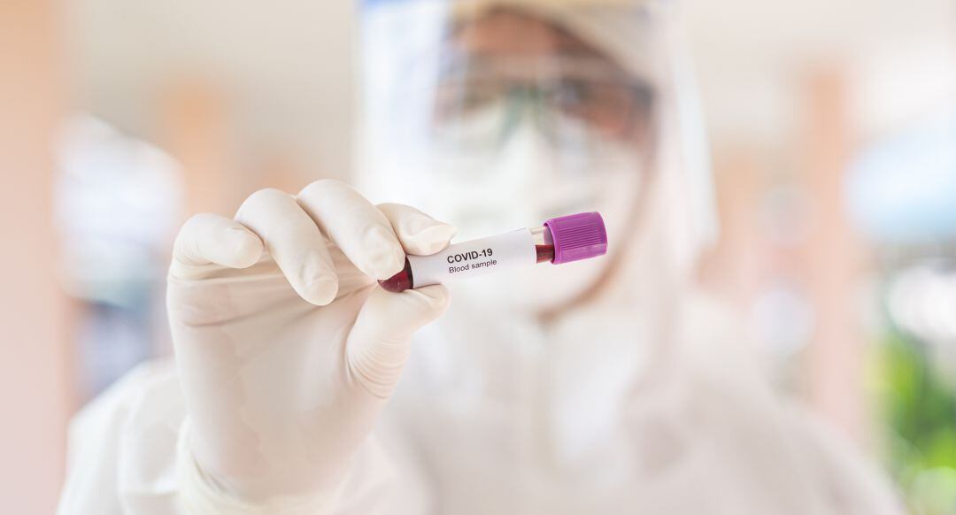 Las autoridades sanitarias reconocen estar preocupadas por el incremento de casos en algunos barrios de la ciudad de Murcia y en Lorca