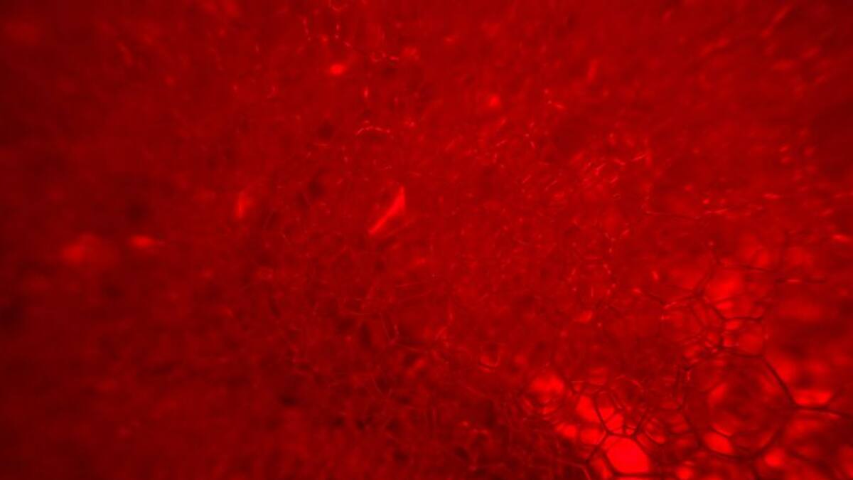 'És necessari que cada dia les persones donin sang'