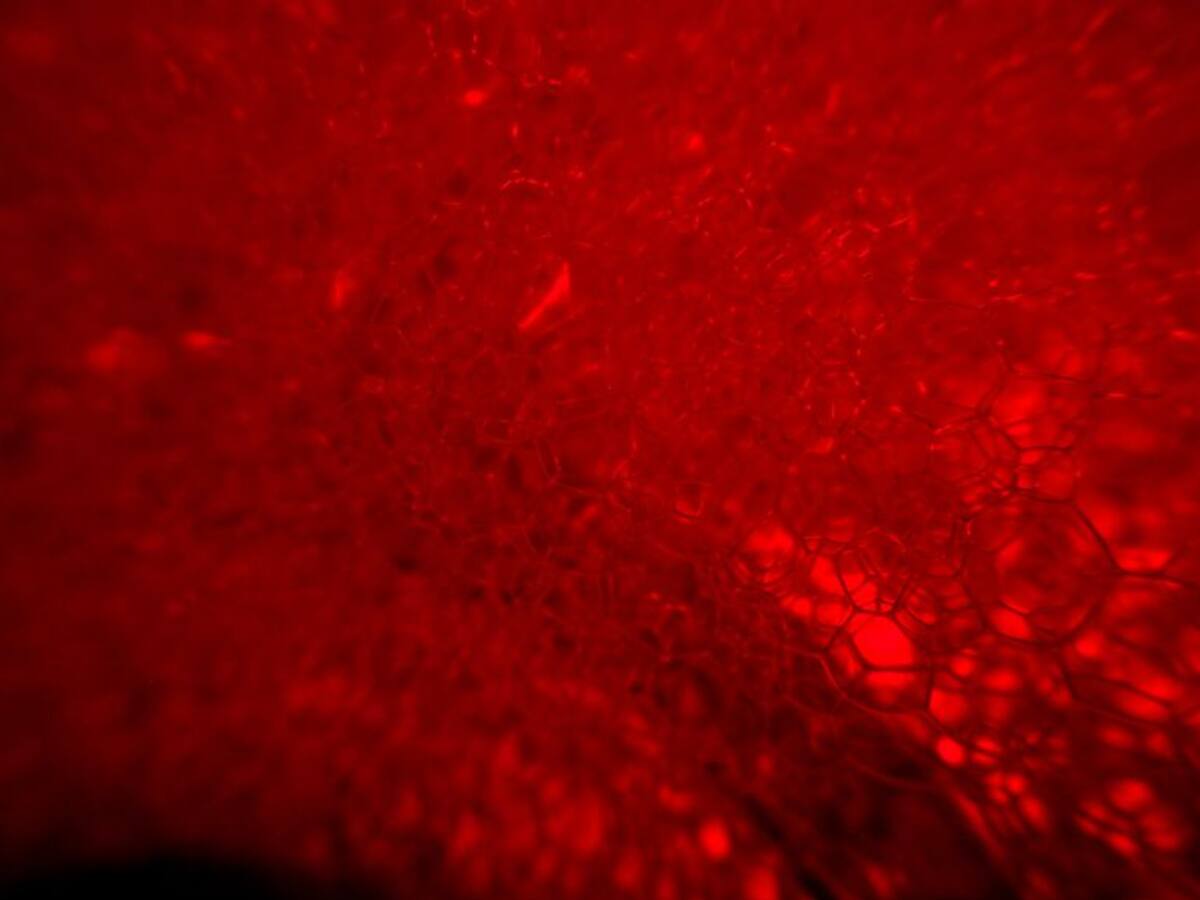 "És necessari que cada dia les persones donin sang"