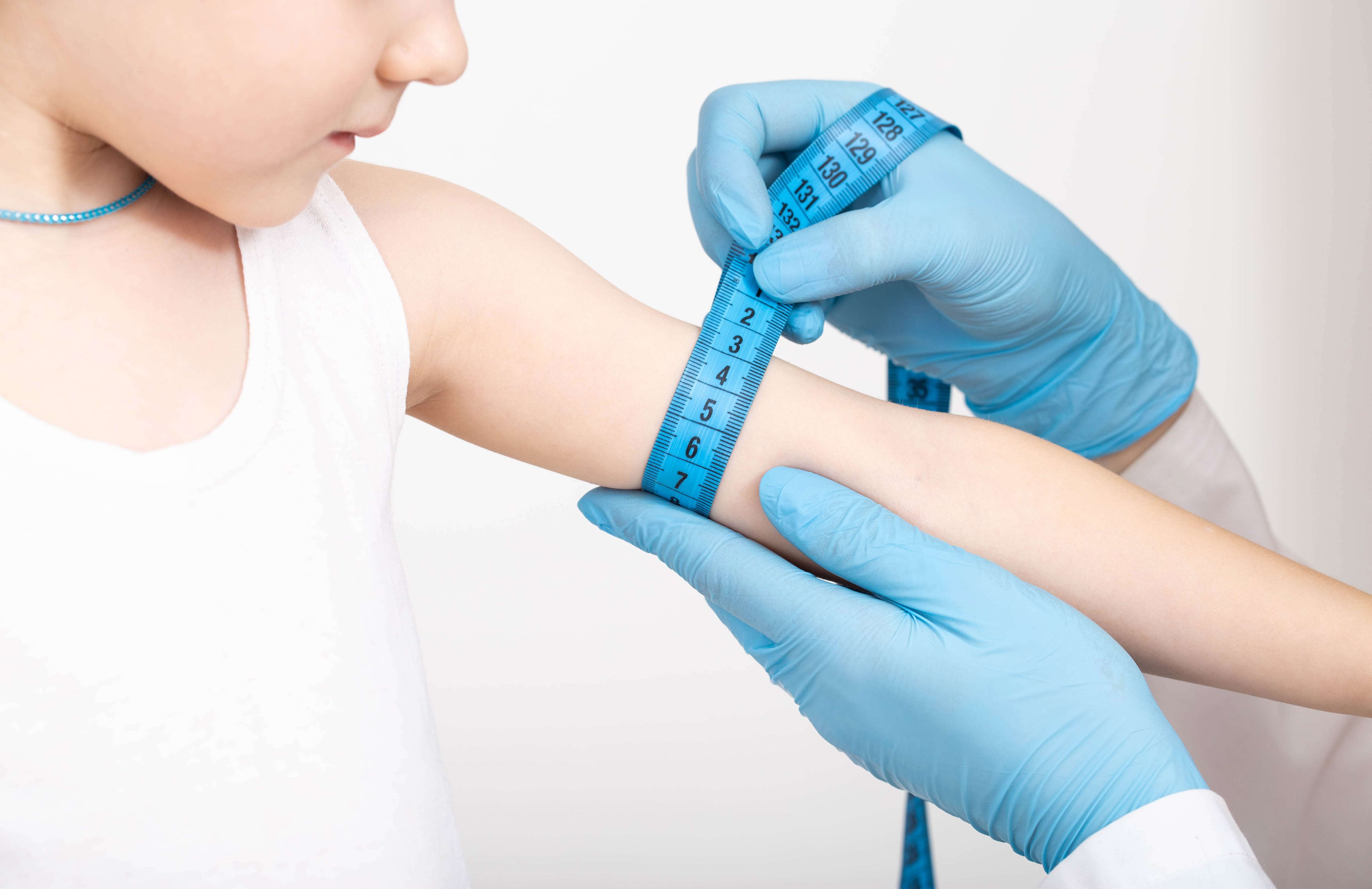 Doctor nutritionist measures the thickness of the child's hand with a measuring tape. The concept of being too thin, underweight, close-up. Girl aged 4
