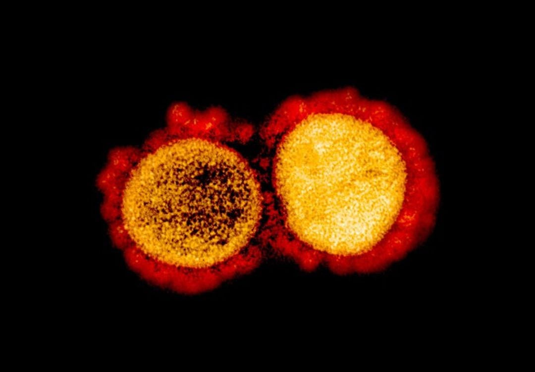 Microfotografía electrónica de transmisión de partículas del virus del SARS-CoV-2.